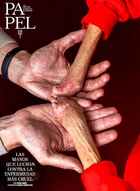 Revista Papel: Las manos que luchan contra la enfermedad mÃƒÆ’Ã‚Â¡s cruel