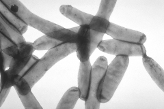 1280px-Legionella_pneumophila_01_0.jpg