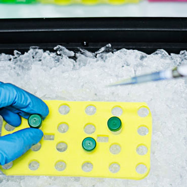Metabolomics Platform