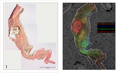 Proteomic Platform